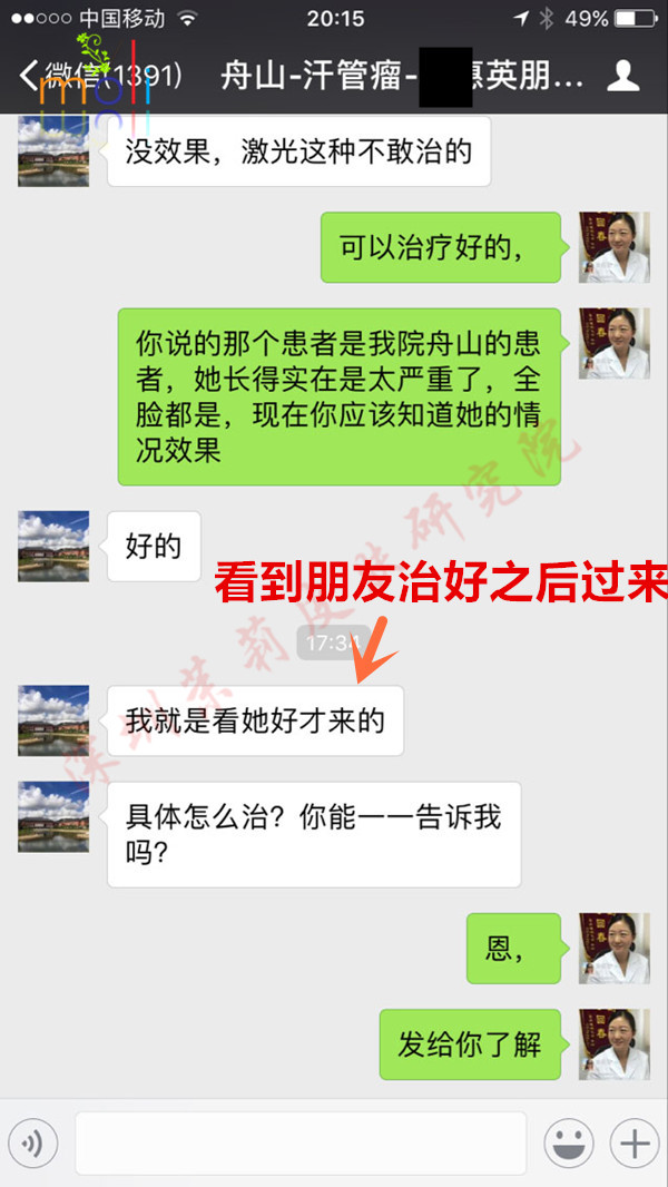 做汗管瘤项目无门槛5折优惠，0压力祛除汗管瘤(图5)