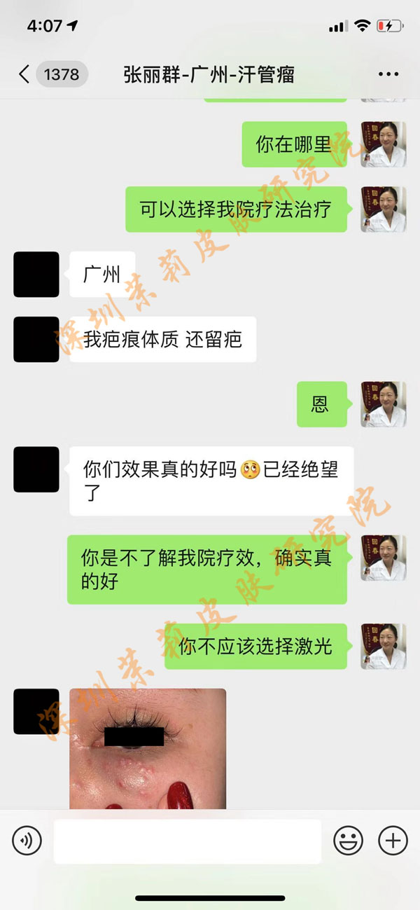 激光治疗汗管瘤皮肤损伤无效案例：（茉莉医生述）(图3)