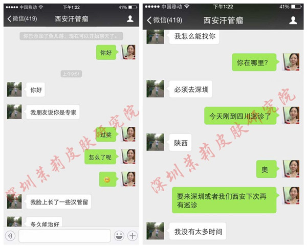 经常晒会加深汗管瘤颜色吗？(图1)