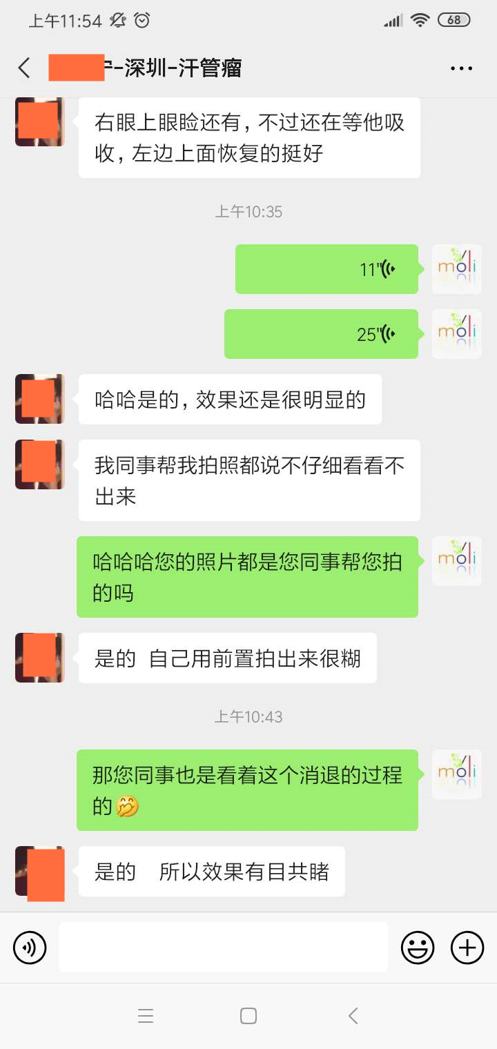 汗管瘤如何才能去除干净？深圳女生使用这种方法(图2)